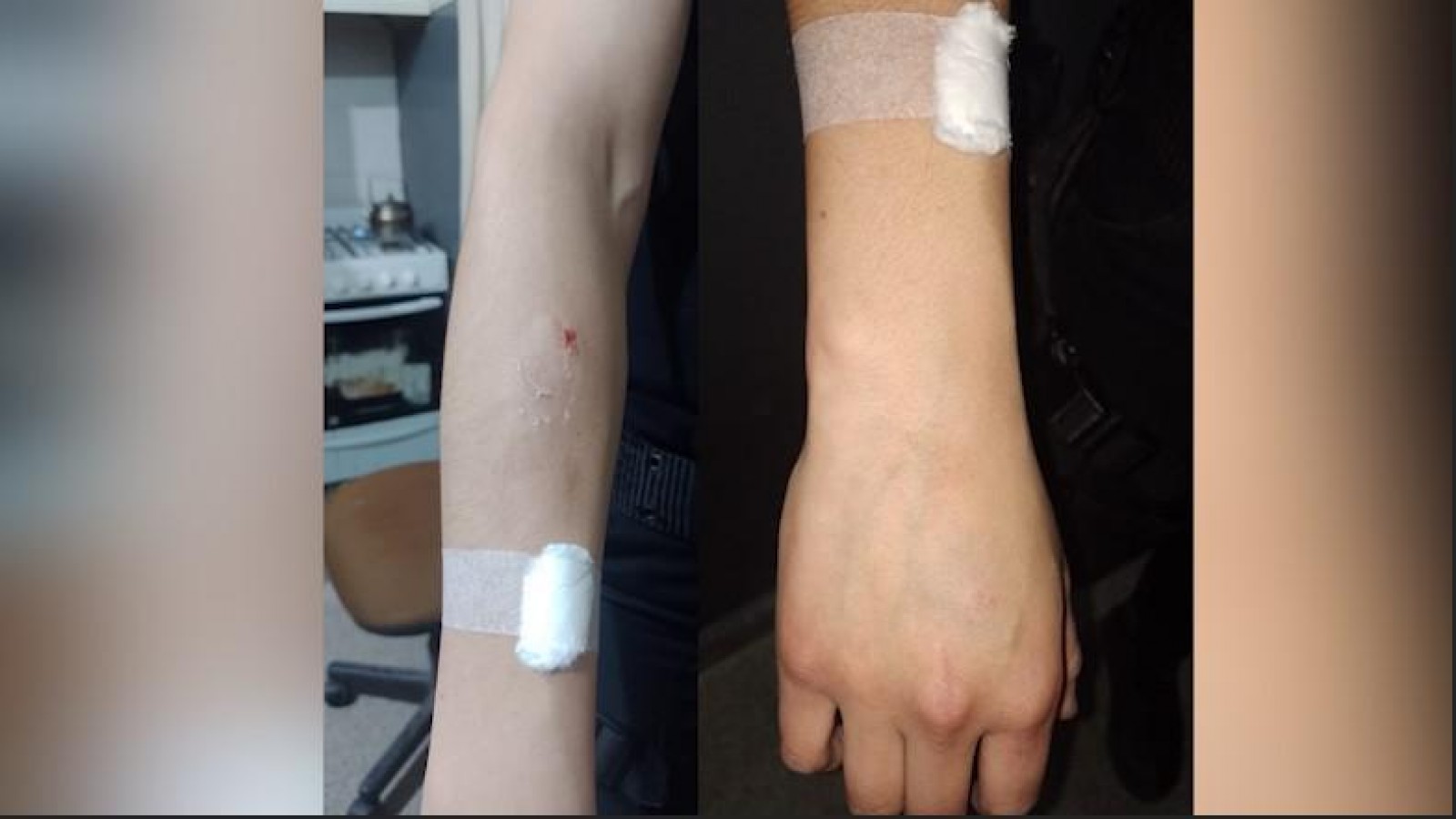 La policía le pidió a un joven que se identifique y respondió con una mordida en el brazo